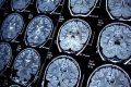 Top US Medical Schools for Neurology Programs Best Schools in America: Top Public & Private Options Top US Medical Schools for Neurology Programs | Best Schools in America: Top Public & Private Options
