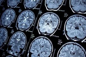 Top US Medical Schools for Neurology Programs Best Schools in America: Top Public & Private Options Top US Medical Schools for Neurology Programs | Best Schools in America: Top Public & Private Options