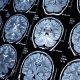 Top Best Neurology Medical Schools: Guide | Best Schools in America: Top Public & Private Options